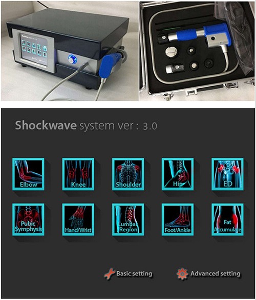 Extracorporeal shockwave therapy device